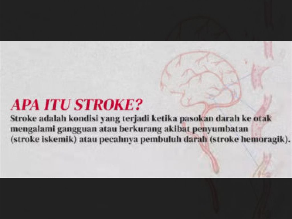 Penyakit yang Mirip Stroke, Tindakan Medis, dan Penggunaan Obat Herbal